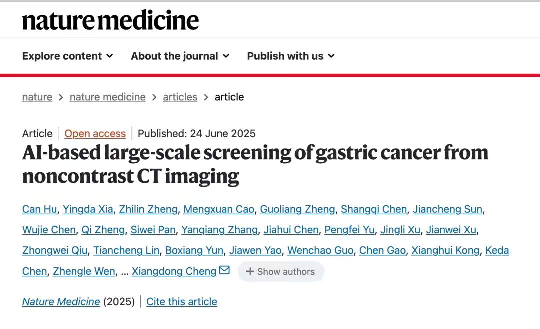 全球首个胃癌影像筛查AI模型发布，平扫CT识别早期胃癌